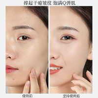 妮致 焕颜紧致精华乳100ml(胶原乳)改善皮肤松垮、双收下巴、紧致提升、全脸提拉上扬、改善皱纹/松弛/下垂肌肤