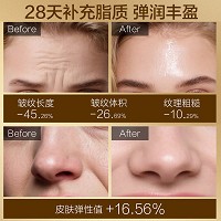 安吉希可儿 奢宠焕颜精华油35ml 以油养肤、补充脂质、抗皱淡纹、紧致弹润、充盈肌肤、修护屏障、透亮焕彩